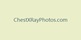 ChestXRayPhotos.com