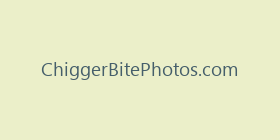 ChiggerBitePhotos.com