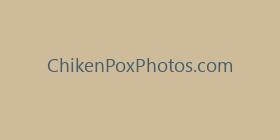 ChikenPoxPhotos.com