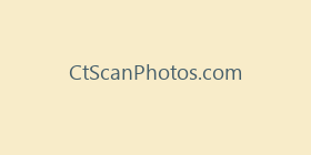 CtScanPhotos.com