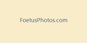 FoetusPhotos.com