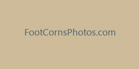 FootCornsPhotos.com