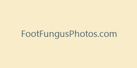 FootFungusPhotos.com