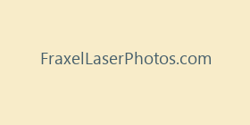 FraxelLaserPhotos.com