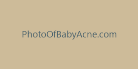 PhotoOfBabyAcne.com