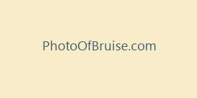 PhotoOfBruise.com