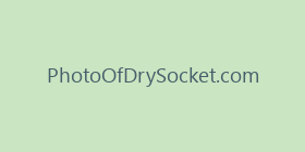 PhotoOfDrySocket.com