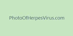 PhotoOfHerpesVirus.com