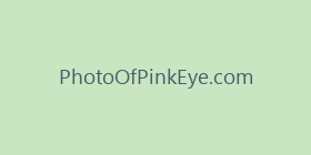 PhotoOfPinkEye.com