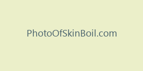 PhotoOfSkinBoil.com