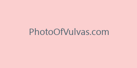 PhotoOfVulvas.com