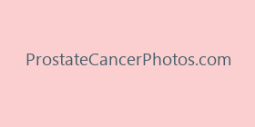 ProstateCancerPhotos.com
