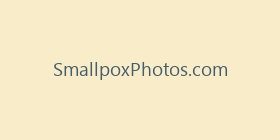 SmallpoxPhotos.com