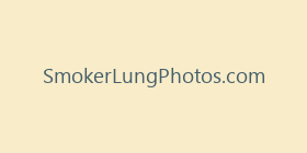 SmokerLungPhotos.com